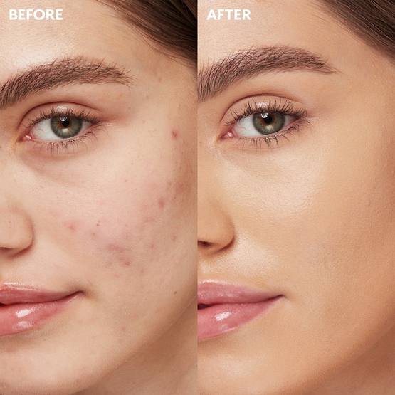KIKO Milano Full Coverage 2-In-1 Foundation & Concealer mocno kryjący podkład i korektor 2 w 1 Warm Rose 10 25ml